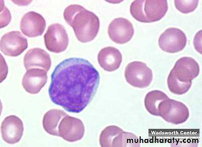 ACUTE LEUKEMIA