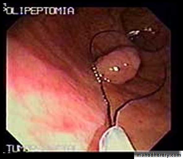 bleeding
