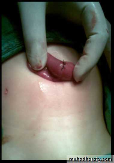 bleeding