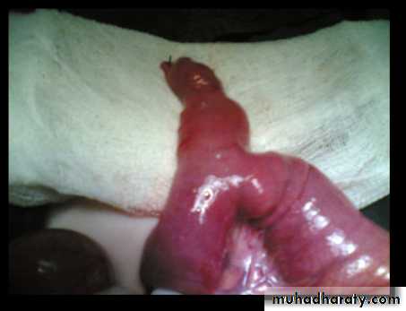 bleeding