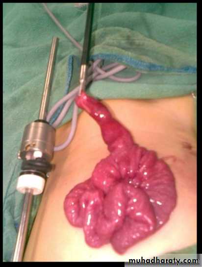 bleeding