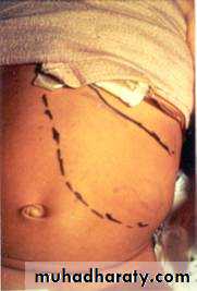 PEDIATRIC ONCOLOGY
