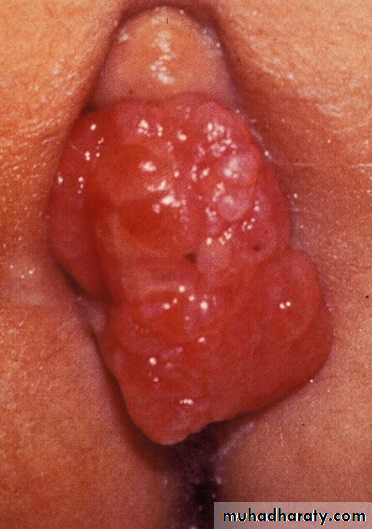 PEDIATRIC ONCOLOGY