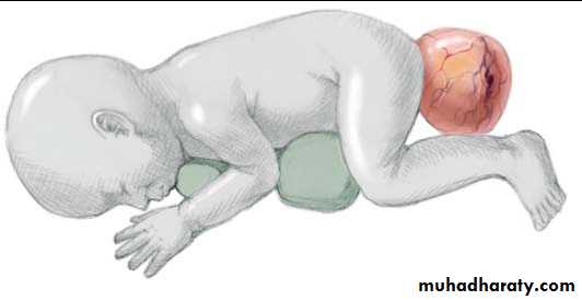 PEDIATRIC ONCOLOGY
