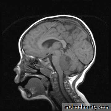PEDIATRIC ONCOLOGY