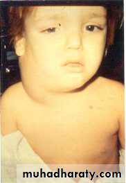 PEDIATRIC ONCOLOGY