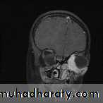 PEDIATRIC ONCOLOGY