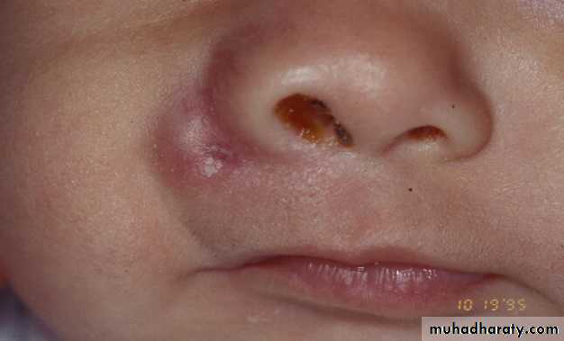 PEDIATRIC ONCOLOGY