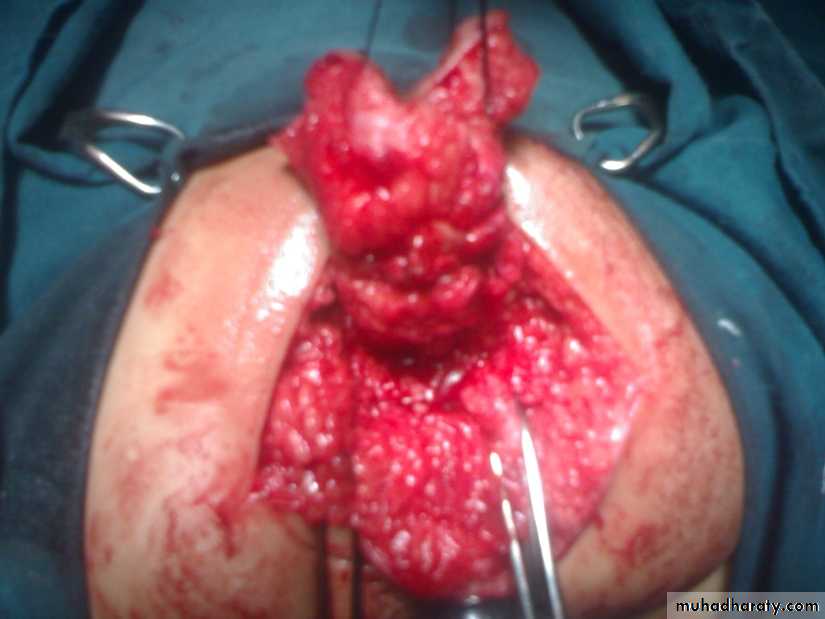 PEDIATRIC ONCOLOGY