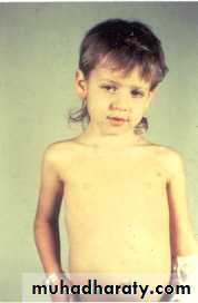 PEDIATRIC ONCOLOGY