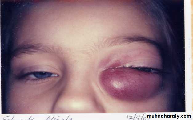 PEDIATRIC ONCOLOGY