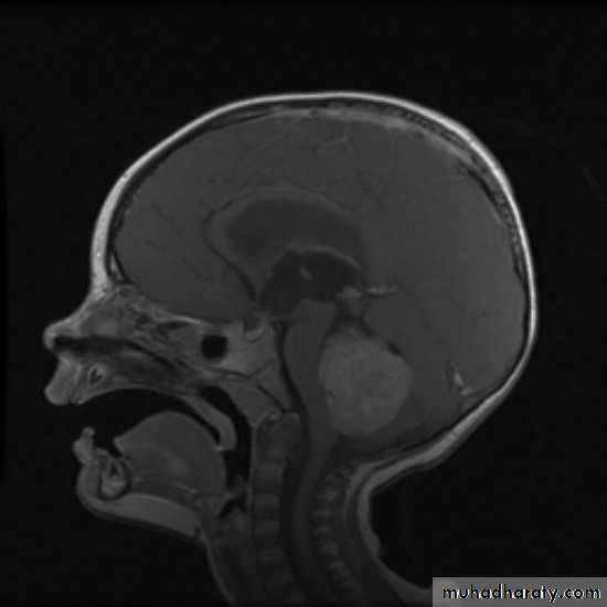 PEDIATRIC ONCOLOGY
