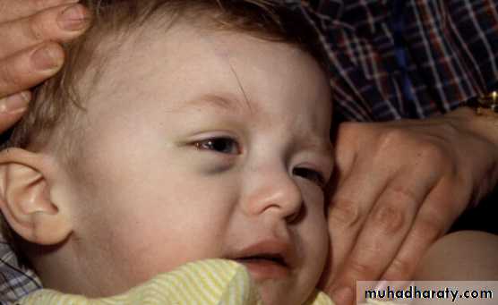 PEDIATRIC ONCOLOGY