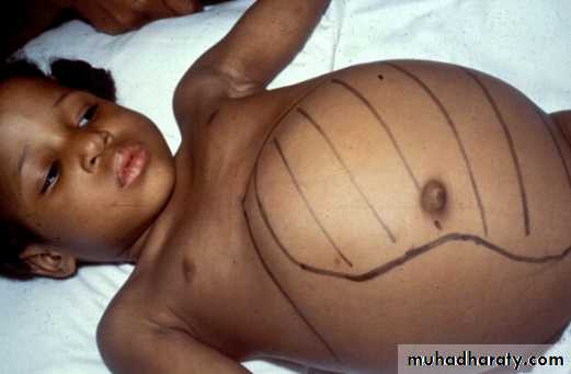 PEDIATRIC ONCOLOGY