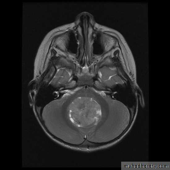 PEDIATRIC ONCOLOGY