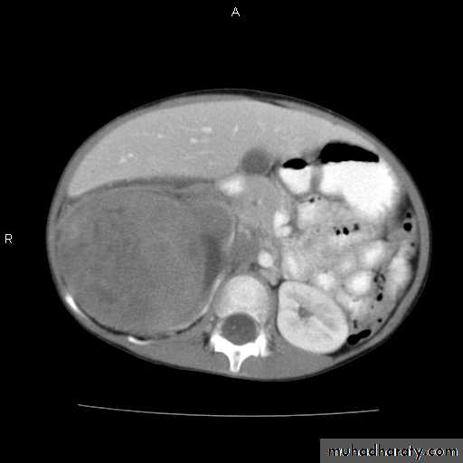 PEDIATRIC ONCOLOGY