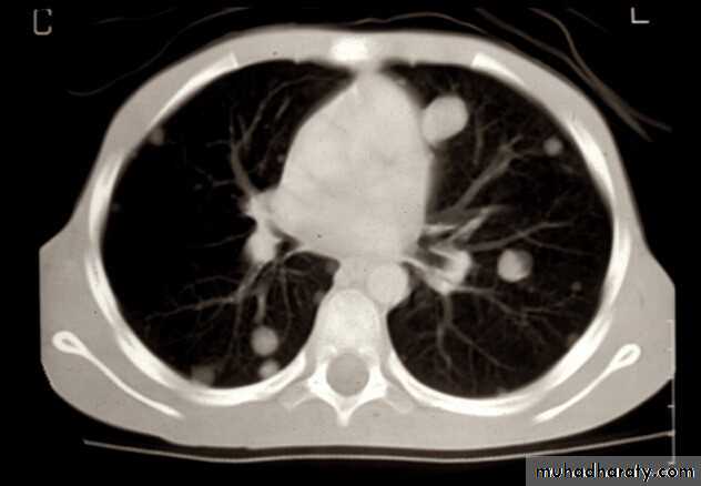 PEDIATRIC ONCOLOGY