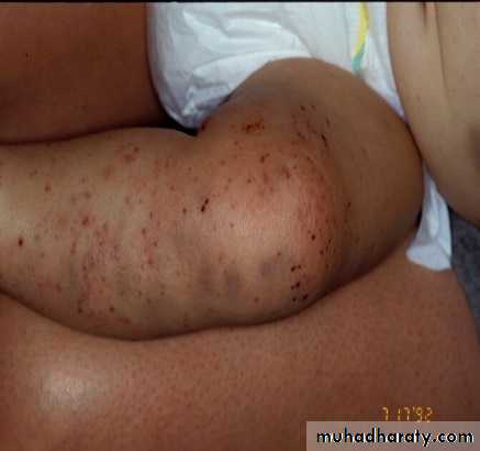 PEDIATRIC ONCOLOGY