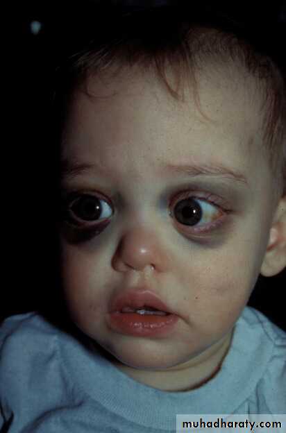 PEDIATRIC ONCOLOGY