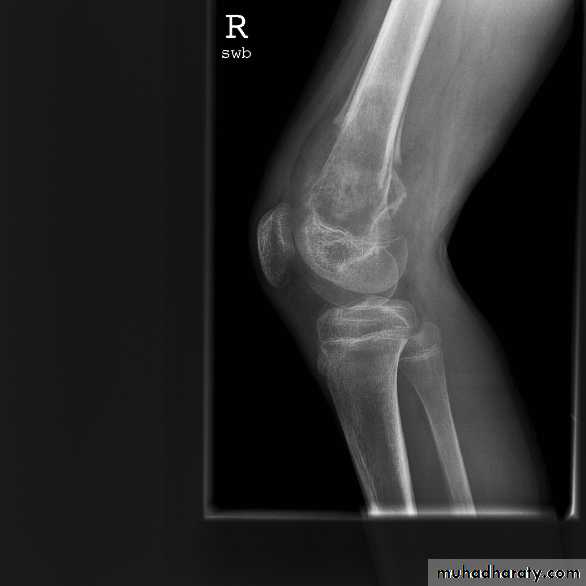 PEDIATRIC ONCOLOGY