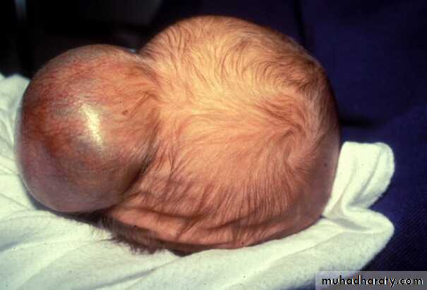 PEDIATRIC ONCOLOGY
