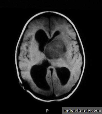 PEDIATRIC ONCOLOGY