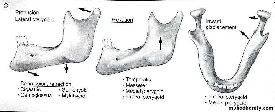 Facial fractures