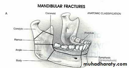 Facial fractures