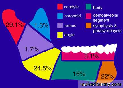 Facial fractures