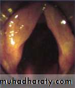 larynx