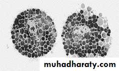 IMMUNOPATHOLOGY