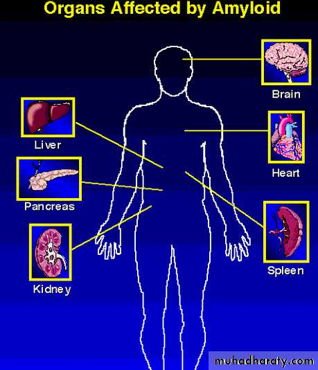 Amyloidosis