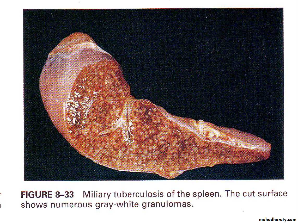 infectious disease
