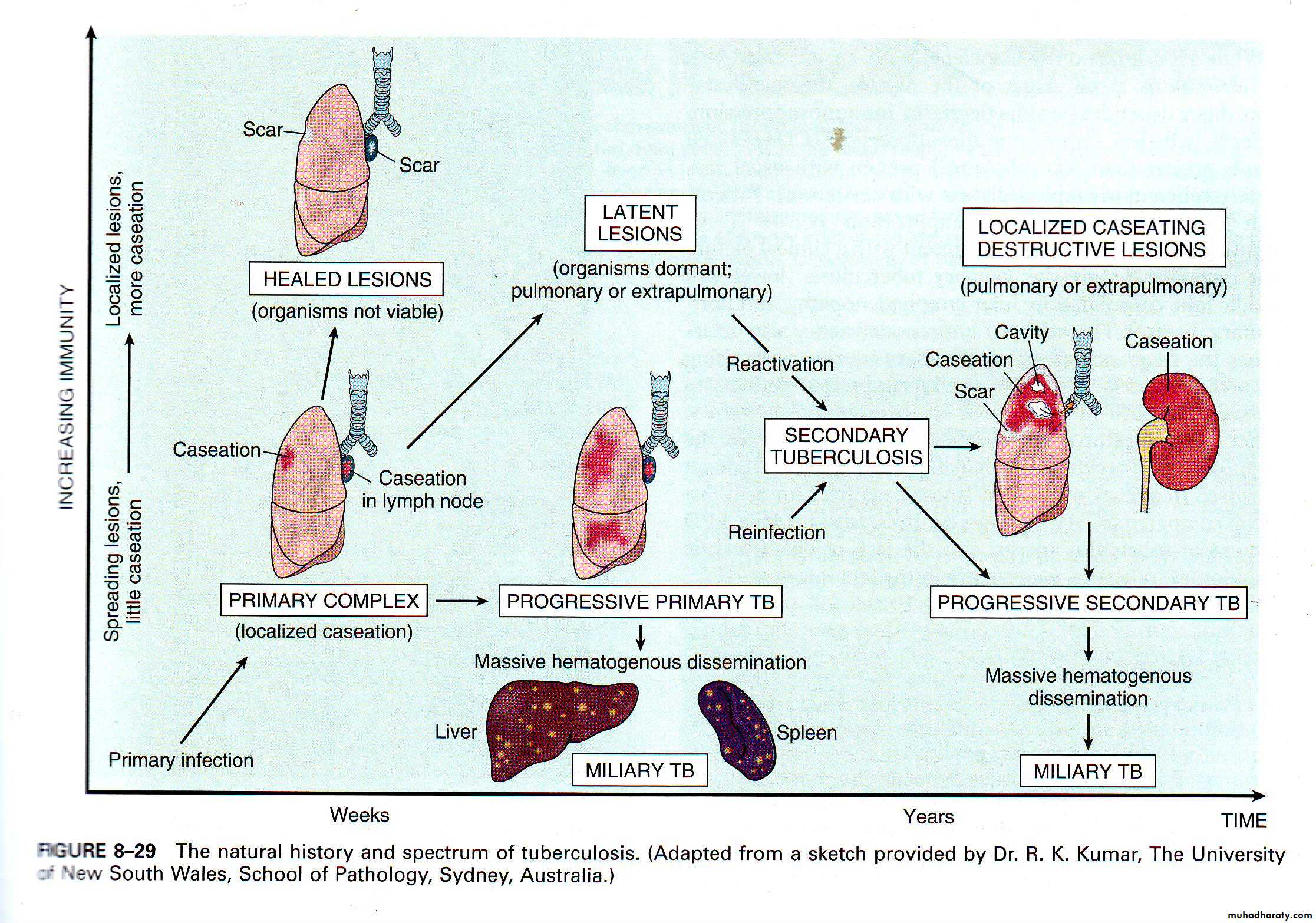 infectious disease