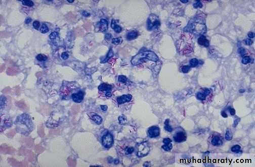 infectious disease