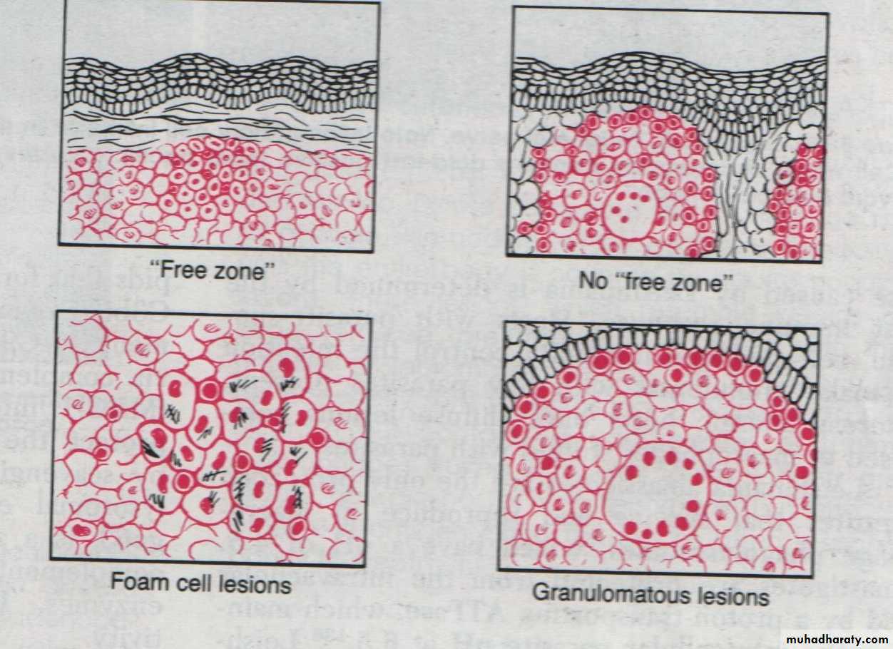 infectious disease