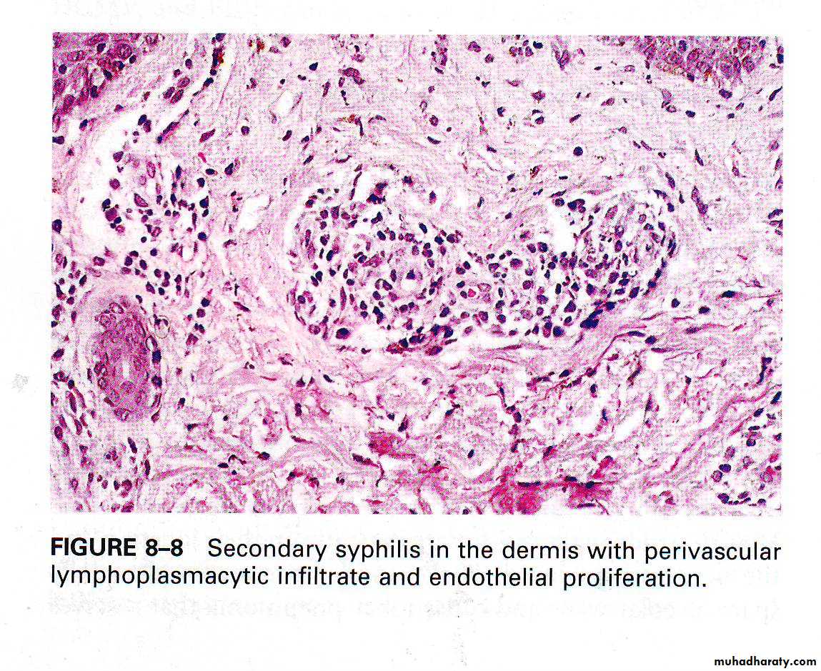 infectious disease