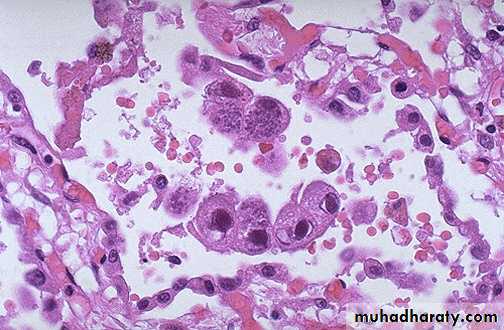 infectious disease