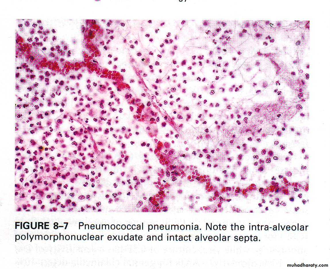 infectious disease