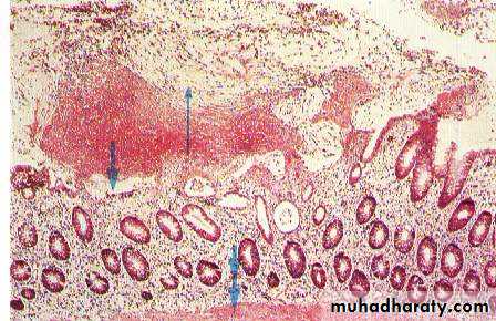 infectious disease