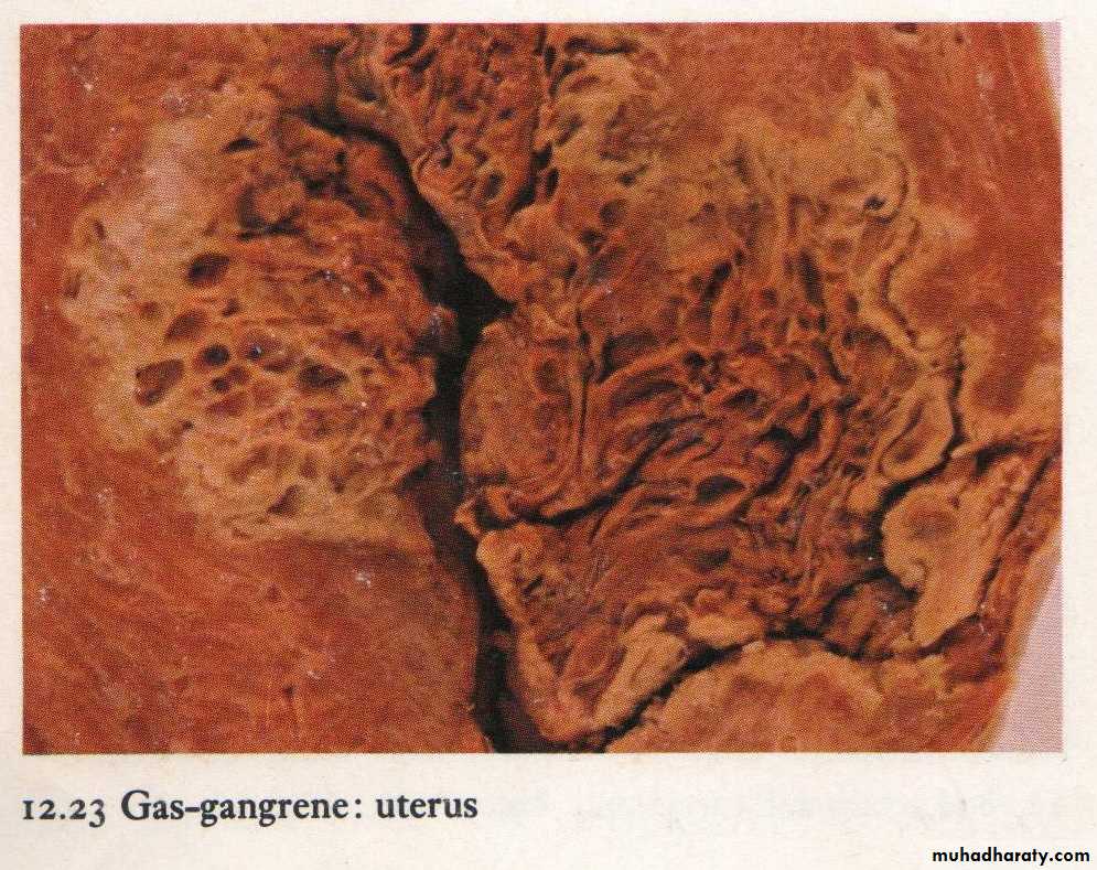 infectious disease