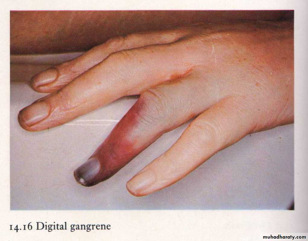 infectious disease