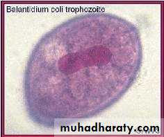 Balantidium coli