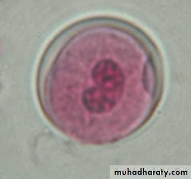 Balantidium coli