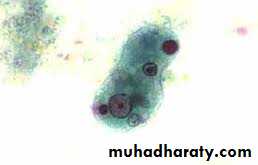 ENTAMOEBA HISTOLYTICA