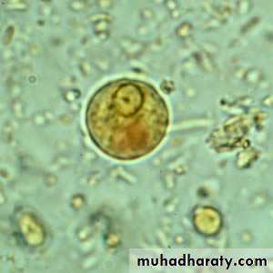 ENTAMOEBA HISTOLYTICA