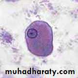 ENTAMOEBA HISTOLYTICA