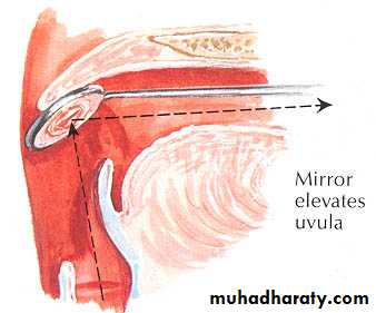 larynx
