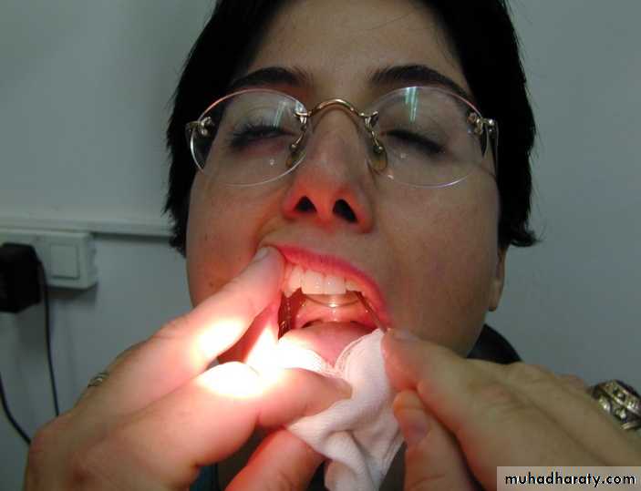 larynx