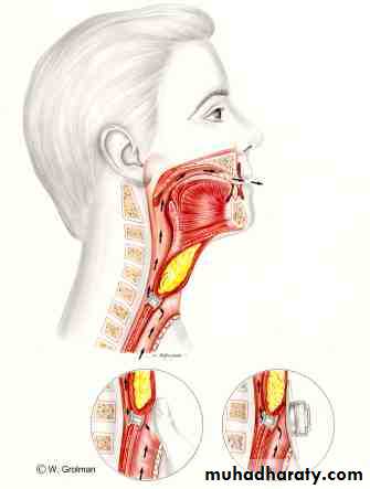 larynx